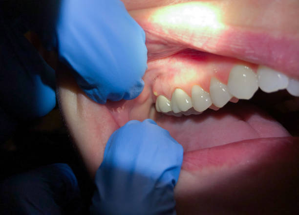 Best Pediatric Emergency Dentist in Fernandina Beach, FL